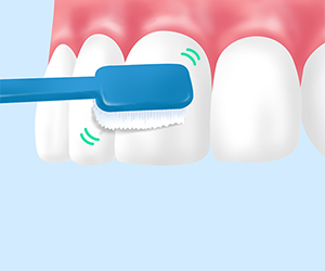 ブラッシング指導
