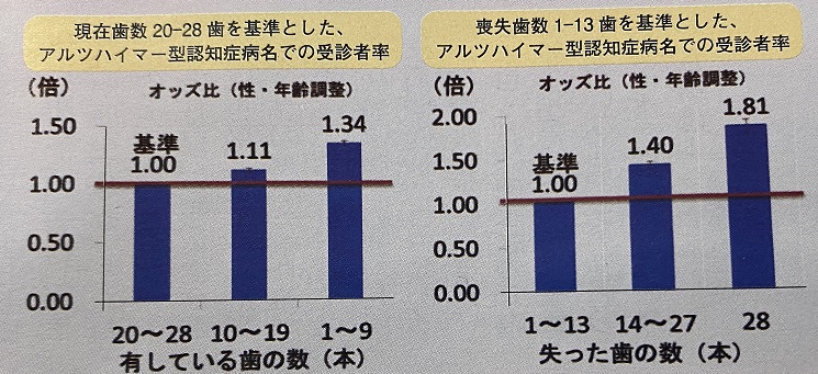 歯の数とアルツハイマー